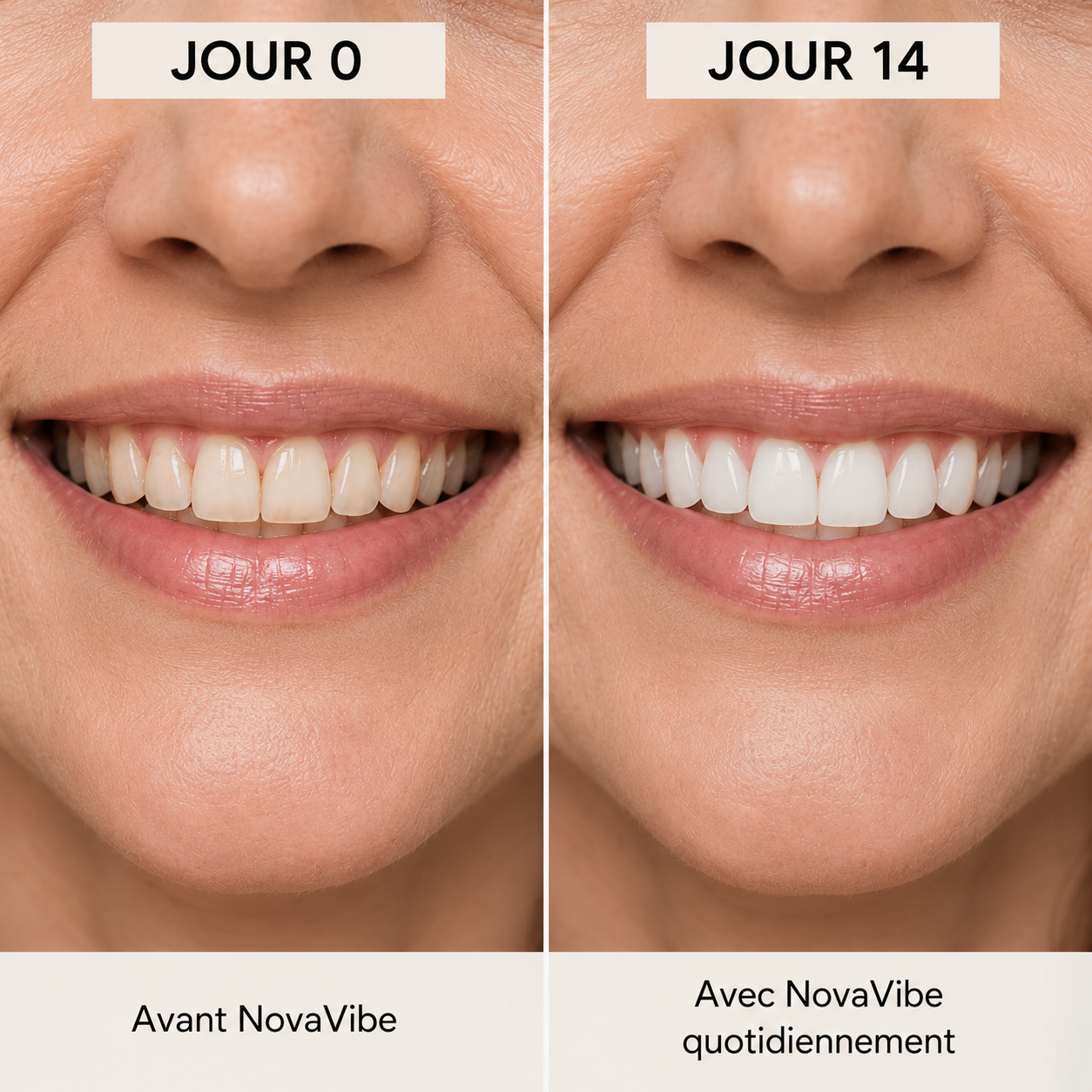 Brosse à dents sonique 360° nouvelle génération