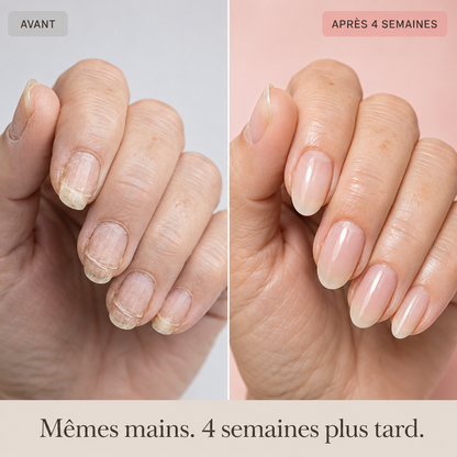 Sérum réparateur & fortifiant pour ongles