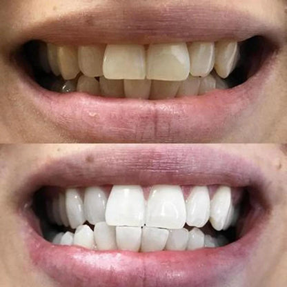 28 Bandes blanchissantes pour les dents